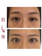 シーフェイス(see face)/目がスカッと！ぱっちり