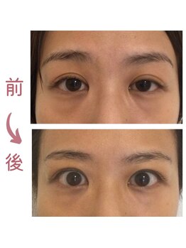 シーフェイス(see face)/目がスカッと！ぱっちり