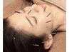 【リフト小顔美容鍼】根本から肌質改善＋むくみ解消し速攻で小顔実感￥8800→