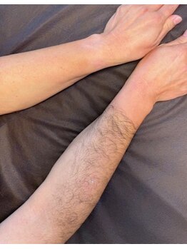 フレドネ(FREDONNER)/どちらが印象の良さそう?