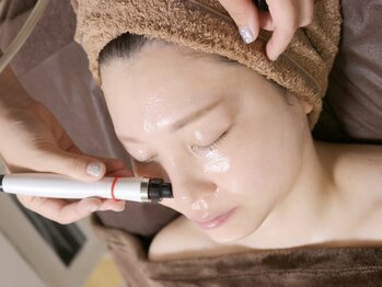 マオ(mao)の写真/毛穴汚れ&ニキビケア【美容液毛穴洗浄＊ハイドロピーリング(全顔)¥4980】季節の変わり目の肌トラブルケアに