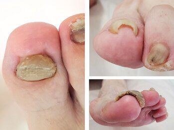 セイラ(Seila)の写真/足・爪のケアやお悩みはプロにおまかせ♪足トラブルを根本から改善する『ドイツ式フットケア』をご提供☆