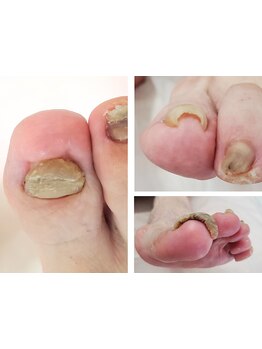 フットネイルがおすすめのサロン
