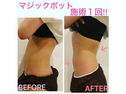 エステアンドヘアーサロン アルテ 札幌の写真