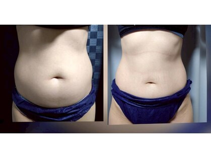 パリエボーテ 静岡の写真