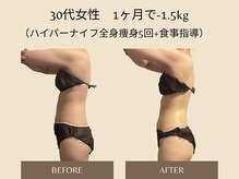 オベリオ(OBERIO)/ハイパーナイフ全身痩身