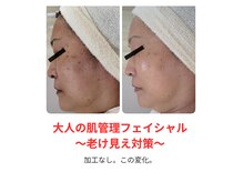 レゾン 京橋店の雰囲気（《ビフォーアフター》40代以上のスタッフが担当。大人の肌管理☆）