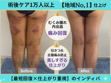 インディバ痩身サロン プルミエ(premier)