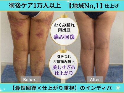 インディバ痩身サロン プルミエ(premier)の写真