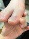 ランランネイル(rangrang nail)の写真/【無料駐車場有】巻き爪矯正は痛いというイメージを覆す「綺麗な巻き爪補正」。多くの実績はブログをcheck!