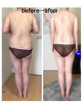 ハーティ(hati)/お客様before→after！