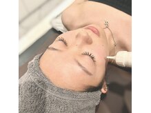 リエート(LIETO)の雰囲気（ピンポイントでシミ改善、その他お悩みに合わせた施術をご提案！）