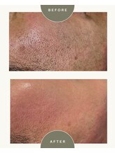 ビーカーブス 三鷹(B.curves)/before・after