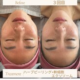 エム シャルール(M chaleur)