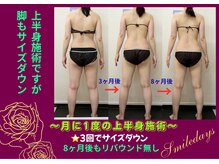 スマイルデイズ(Smiledays)の雰囲気（冬のイベントに自信をつけるチャンス！痩身機が断然効果あり！）