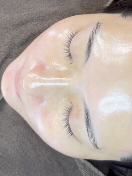 美白ケアをしたい