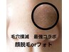 最強毛穴洗浄&【お好きなチョイス】顔脱毛orフォト