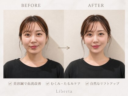 リベルタ鍼灸整骨院 なんば店(Liberta鍼灸整骨院)の写真