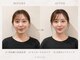 リベルタ鍼灸整骨院 なんば店(Liberta鍼灸整骨院)の写真