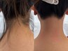 うなじ【ダブル脱毛】ワックス＋最新光脱毛