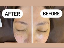 レコルト デ ベルシア BELCIA福岡店(recolte de BELCIA)/3dブロウラミネーション