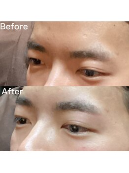 眉毛ハウス 吉祥寺店(眉毛HOUSE)/お客様の施術例(吉祥寺/東京)