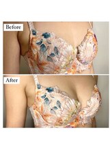 アンシャンテ(ENCHANTER)/光バストアップ