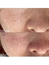 ラヴァン(LaVan)/復元パック