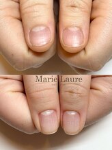 マリーロール 天王寺店(Marie Laure)/深爪矯正/自爪育成/ネイルケア/