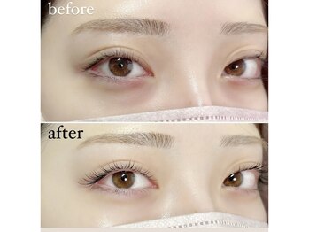 アイリス(EYELISS)/