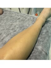 星空脱毛/足もツルツル！