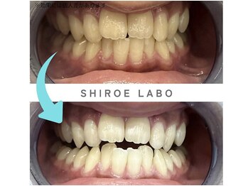 シロエラボ 梅田店/before after