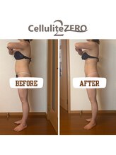 メリッサ(Melissa)/【痩身】自己流で事故らない