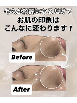 ビレボ マエバシ(BEREVO maebashi)/Before After