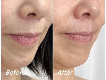 ドクターボディ 新宿店(Dr.Body)/【人中短縮 50代】