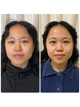 ニコ 加古川店(nico)の写真/【ヘッドスパ×よもぎ蒸し】むくみ解消で叶うスッキリ小顔