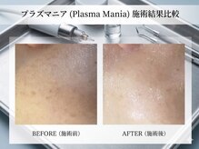 イノエ(inoe)の雰囲気（気になる肌のくすみにも。脱くすみで透明感あふれる素肌へ◎）