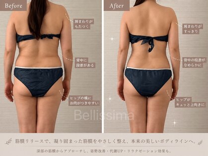 ベリッシマ 北仙台(Bellissima)の写真