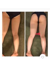 ランベリー 新宿店(Lembellir)/美脚アロマリンパ