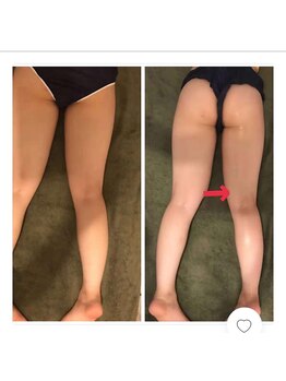 ランベリー 新宿店(Lembellir)/美脚アロマリンパ