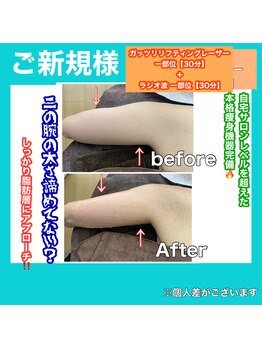 ビューティ ウィッチ(Beauty Witch)/ショット数無制限◎