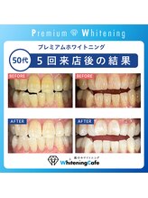 ホワイトニングカフェ イオン新潟青山店(WhiteningCafe)/★★歯科提携★★プレミアムWC