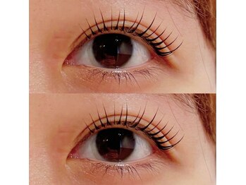 ベルファ 松戸店(BelleFee)/ピーナッツロッド