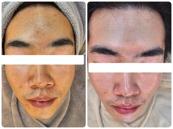 クレイルサロン(Claire salon)/ソフトハーブコース