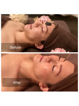 ローズボディ 恵比寿店/キャビで、小顔スッキリ!