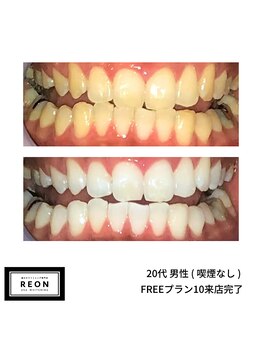 レオン 磐田(REON)/◇ お客様 before＆after ◇