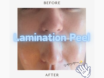 フィル 名駅店(fil)/LaminationPeel