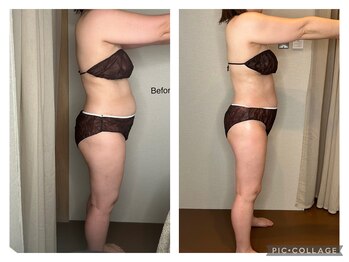 オント(ONTO)/ウインバックボディー効果