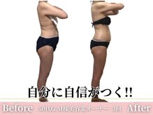 アメリイ 百合ヶ丘 新百合ヶ丘(Amerii)/痩身3回で痩せて引き締まってる!