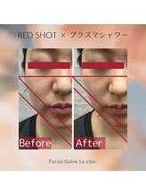 ラシック 加古川店(La chic.)/リバウンドしにくい効果